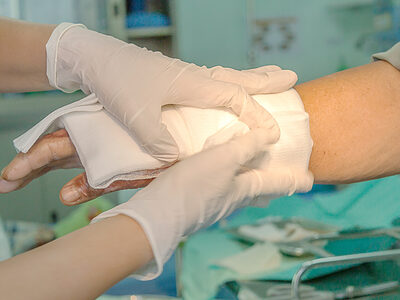 Die Klinik für Plastische, Rekonstruktive, Ästhetische und Handchirurgie am Klinikum Bayreuth hat sich auf die Behandlung von Arbeitsunfällen spezialisiert.